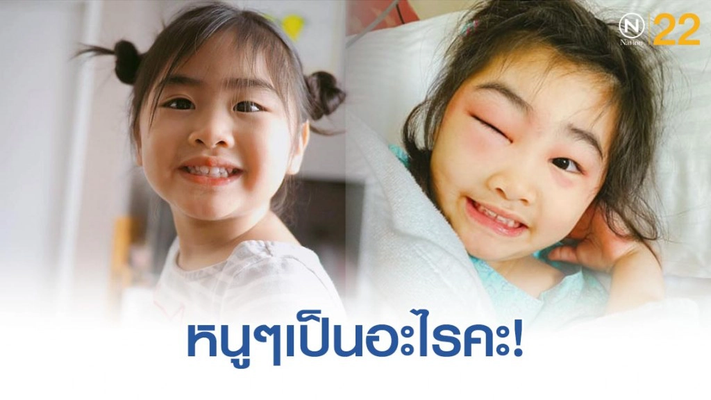 "ชูใจ"ถึงป่วยเเต่ยังน่ารักเหมือนเดิม