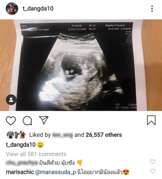 ยินดีด้วย!! "ธีรศิลป์" ได้ข่าวดี กำลังมีลูกคนที่สอง แข้ง "ช้างศึก" ร่วมยินดีเพียบ