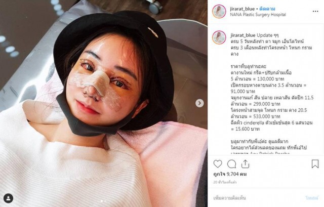 "บลู จิรารัตน์" ทุ่มเงินล้านบินตรงเกาหลี ศัลยกรรมยกหน้า