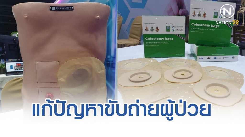 แก้ปัญหาขับถ่ายผู้ป่วยมะเร็งลำไส้-ทวารหนัก
