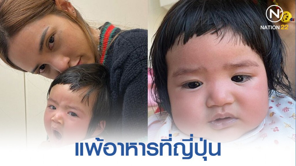 "อุ้ม ลักขณา" โพสต์ไอจี สุดห่วง ลูกแพ้อาหารที่ญี่ปุ่น "อุ้ม ลักขณา" โพสต์ไอจี สุดห่วง ลูกแพ้อาหารที่ญี่ปุ่น