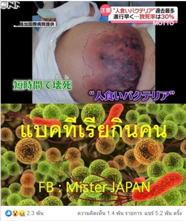 เพจดังเผยภาพเชื้อแบคทีเรีย