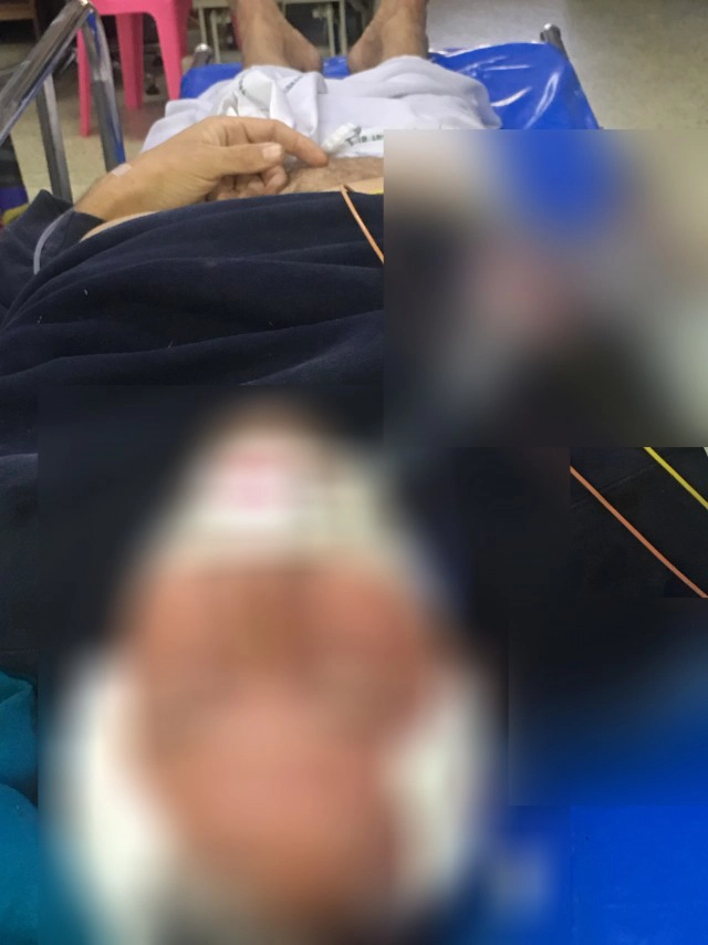 นักโทษฝรั่งโคม่า ตรึงกำลังแน่นโรงพยาบาล