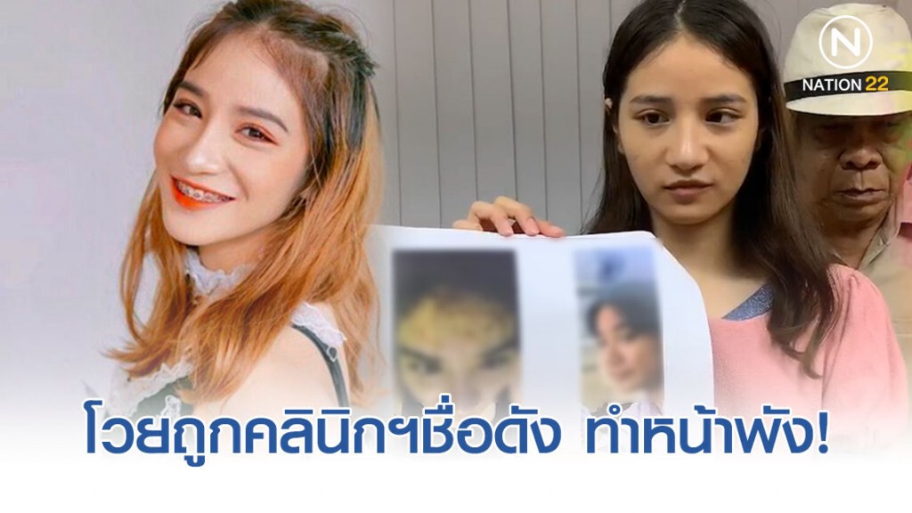 "น้องครีม" เน็ตไอดอล แจ้งความ ปคบ. โวยถูกคลินิกฯชื่อดังใช้สารต้องห้ามผสมเครื่องสำอางจนหน้าพัง!