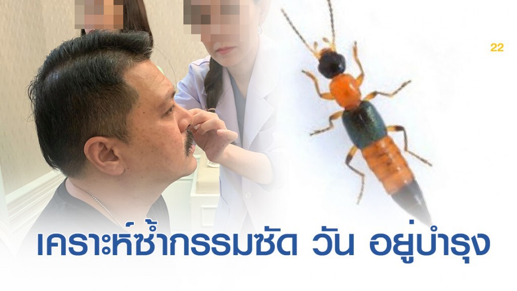 ด้วง(แมลง)ก้นกระดกจู่โจม "วัน อยู่บำรุง" อีก ด้วง(แมลง)ก้นกระดกจู่โจม "วัน อยู่บำรุง" อีก