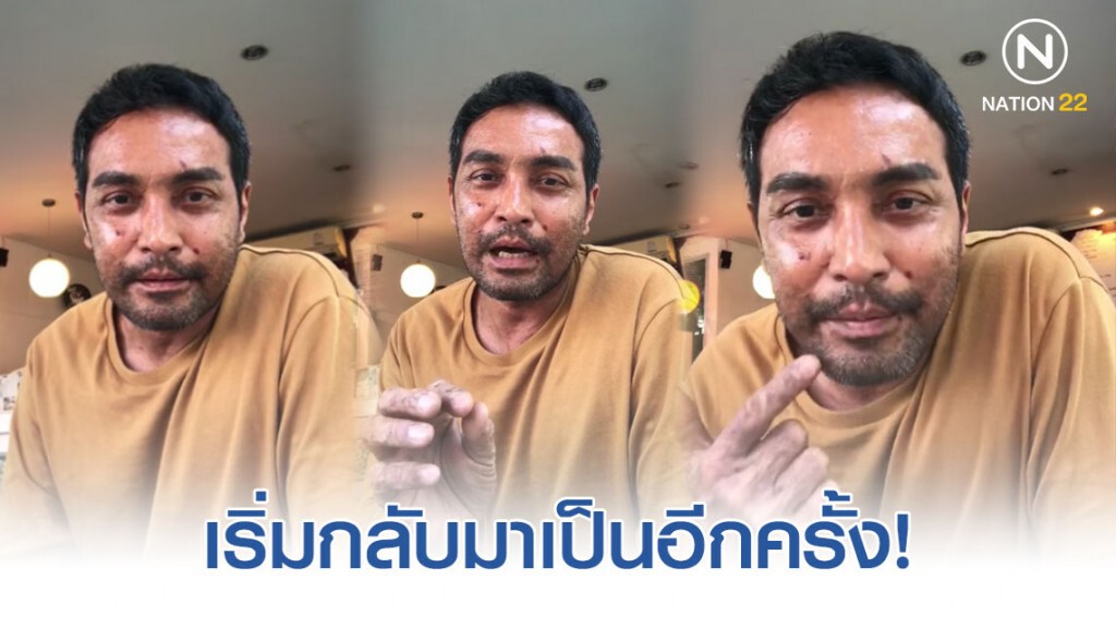 "วินัย ไกรบุตร" ไลฟ์ผ่านเฟซบุ๊กส่วนตัว หลังพบว่าอาการตุ่มน้ำพองกลับมาอีกครั้ง!