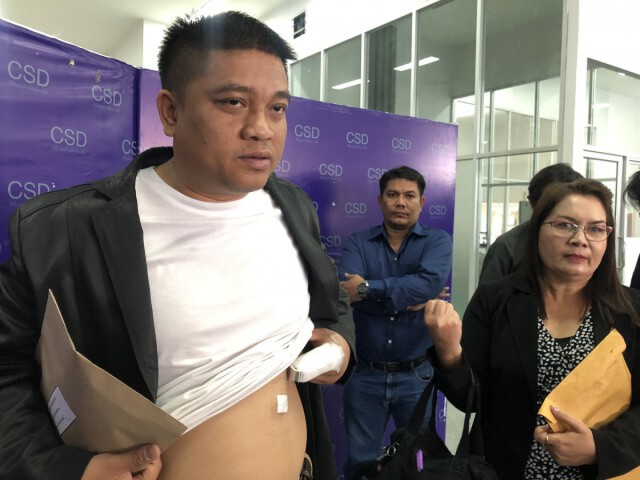 หนุ่มไฟแนนซ์ร้องกองปราบฯถูกทำร้ายขณะเข้ายึดรถ