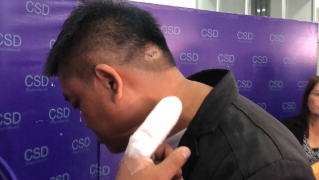 หนุ่มไฟแนนซ์ร้องกองปราบฯถูกทำร้ายขณะเข้ายึดรถ