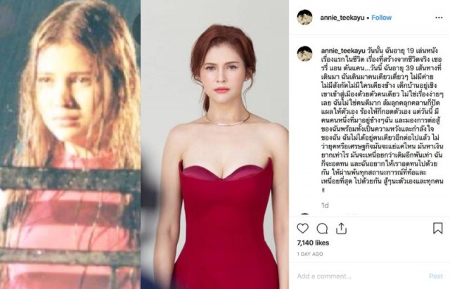 "แอนนี่ บรู๊ค" เล่าความหลังชีวิต ล้มลุกคลุกคลาน วันนี้มีคนข้างๆ