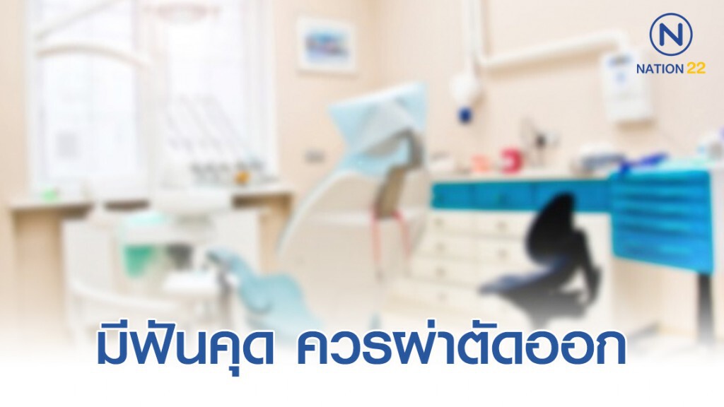 แนะมีฟันคุดควรผ่าตัดออก ป้องกันเหงือกอักเสบ แนะมีฟันคุดควรผ่าตัดออก ป้องกันเหงือกอักเสบ