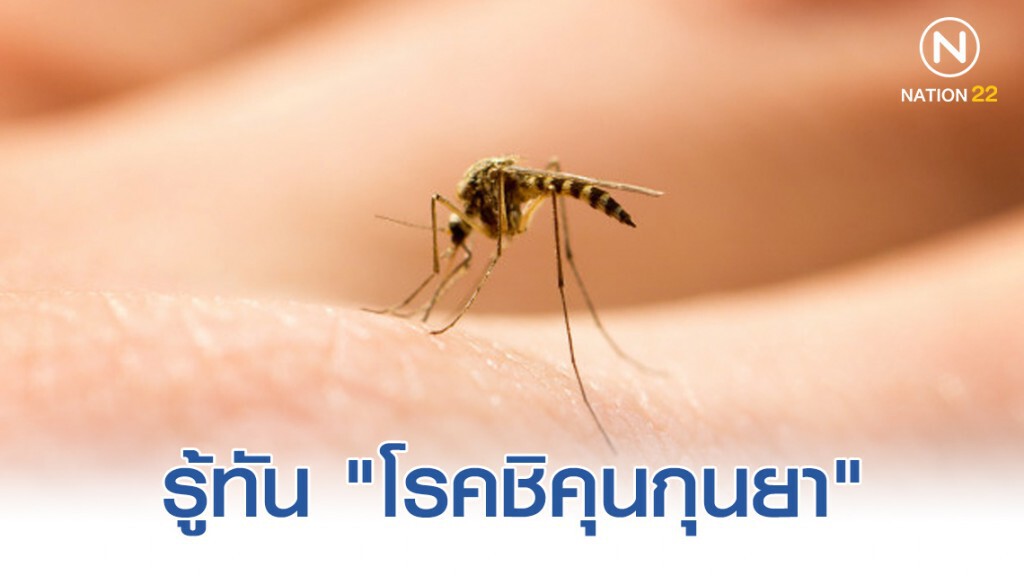 รู้ทัน "โรคชิคุนกุนยา" อีกหนึ่งภัยร้ายที่มาจากยุงลาย