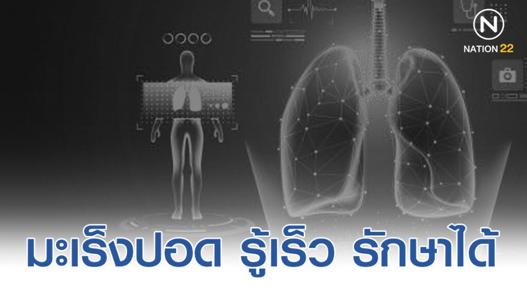 มะเร็งปอด รู้เร็ว รักษาได้