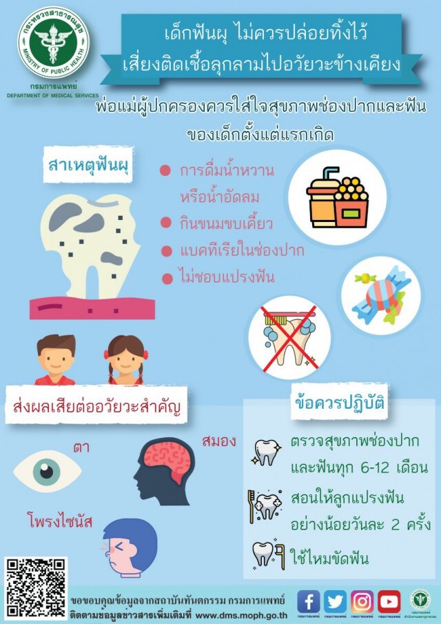 เตือนเด็กฟันผุ ไม่ควรปล่อยทิ้งไว้ เสี่ยงติดเชื้อลุกลามไปอวัยวะข้างเคียง