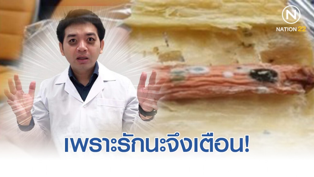 หมอแล็บแพนด้า รักนะจึงเตือน ขนมปังขึ้นรา ไม่ควรกินต่อแล้วนะจ๊ะ!