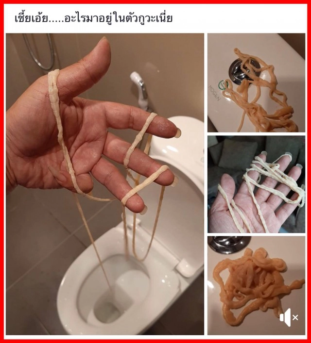 หมอแล๊บ เตือนชัด "สุกๆดิบๆ" แปลว่า "ดิบ"