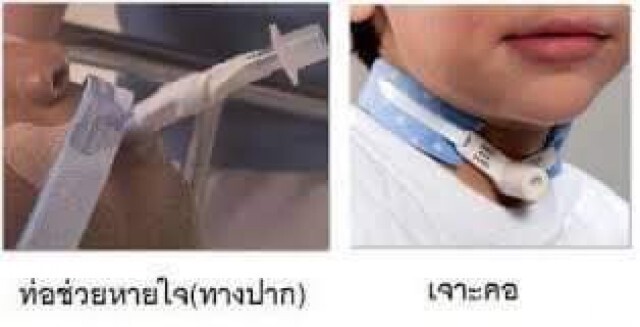 เพจดังเเจง! ดราม่าญาติคนไข้คนนึงโพสต์ด่าหมอเจาะคอญาติ