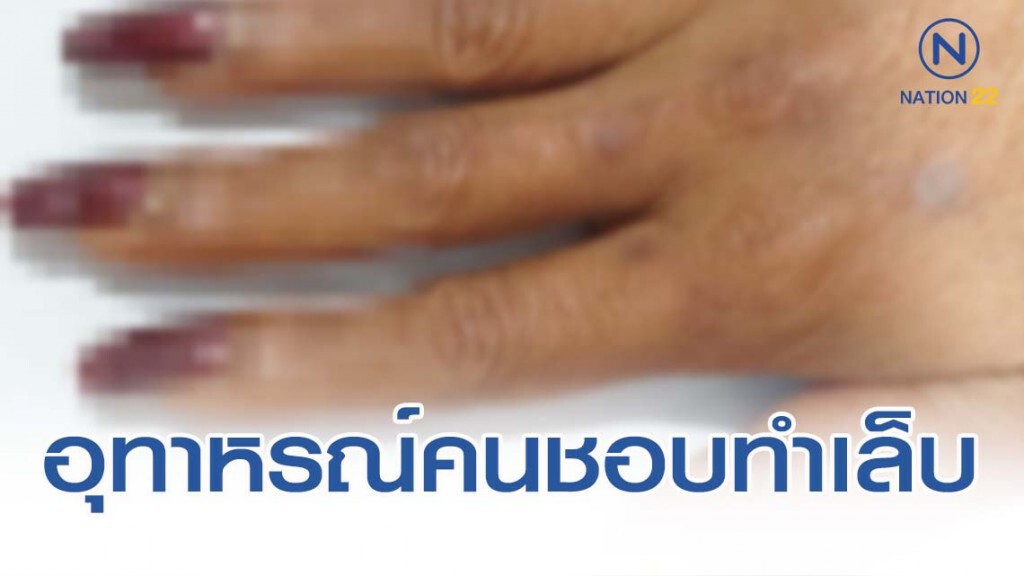 อุทาหรณ์เตือนคนชอบทำ-ตัดแต่ง-ต่อเล็บ อุทาหรณ์เตือนคนชอบทำ-ตัดแต่ง-ต่อเล็บ