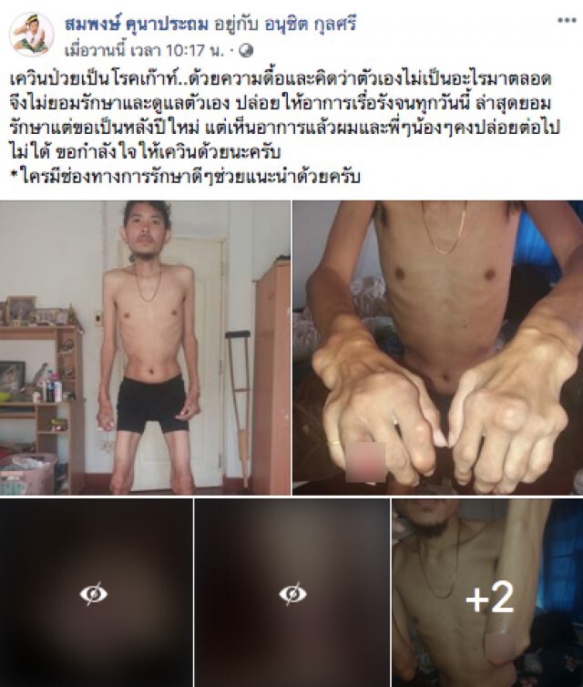 "อี๊ด โปงลางฯ" เผย มือแคน "เควิน" ป่วยหนัก!
