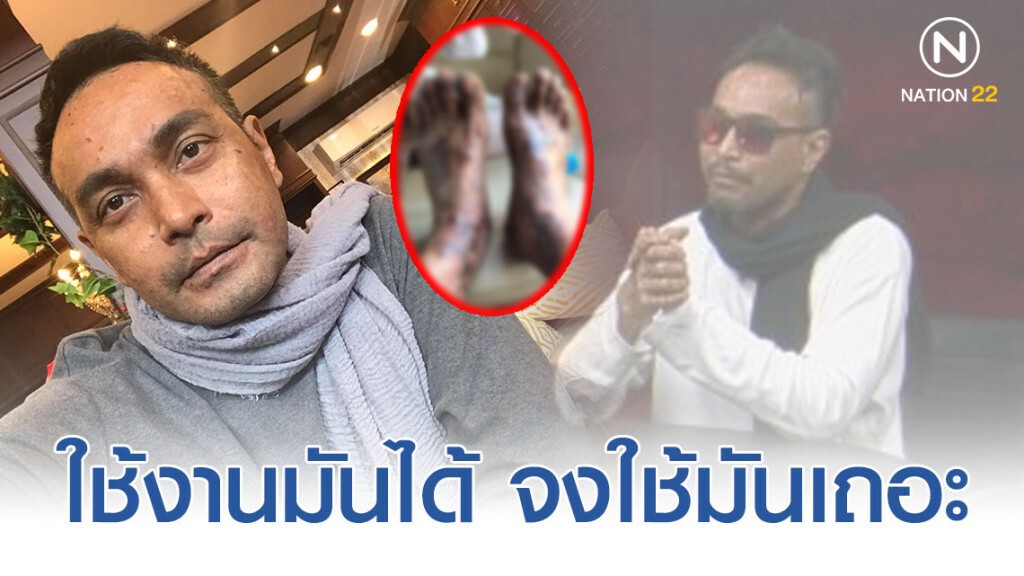 "เมฆ วินัย" โพสต์ภาพปัจจุบัน อาการกำเริบหนัก!