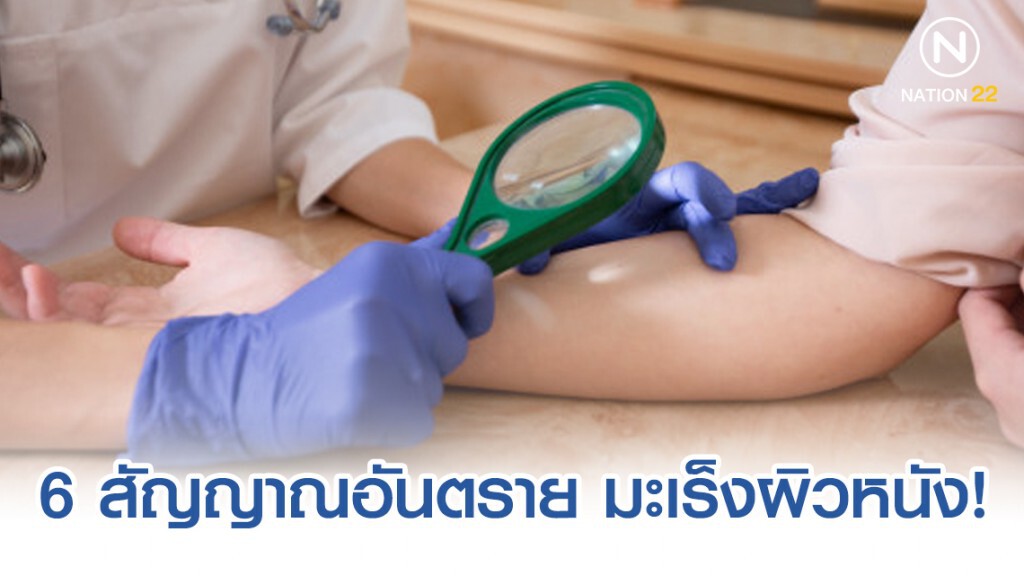 6 สัญญาณอันตราย มะเร็งผิวหนัง! 6 สัญญาณอันตราย มะเร็งผิวหนัง!