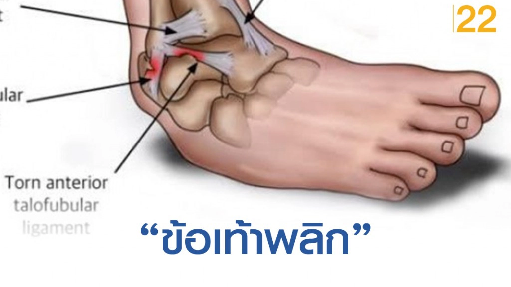 ปัญหาที่เจอในขณะ "วิ่ง" พร้อมเผยวิธีเเก้ ปัญหาที่เจอในขณะ "วิ่ง" พร้อมเผยวิธีเเก้