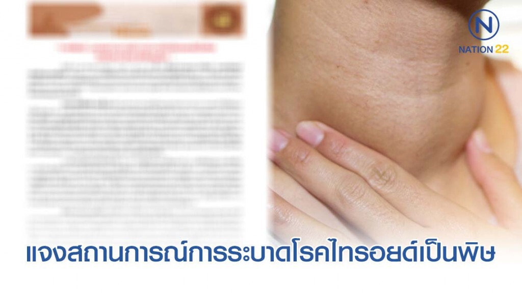 ราชทัณฑ์ แจงสถานการณ์การระบาดโรคไทรอยด์เป็นพิษ ในเรือนจำจังหวัดพิษณุโลก