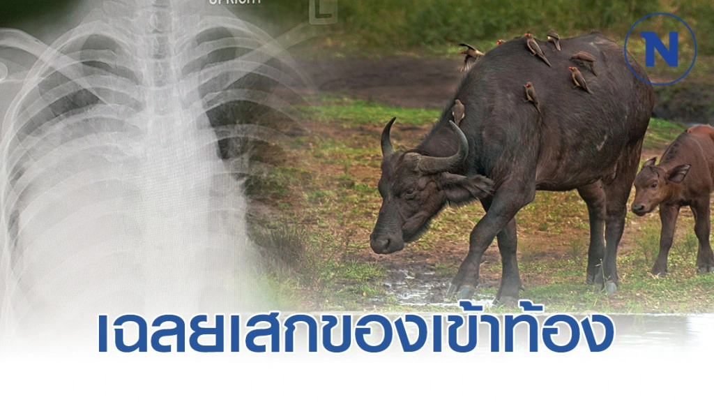 พิสูจน์ความเชื่อ "โดนของเข้าท้อง" ไม่ใช่คุณไสย