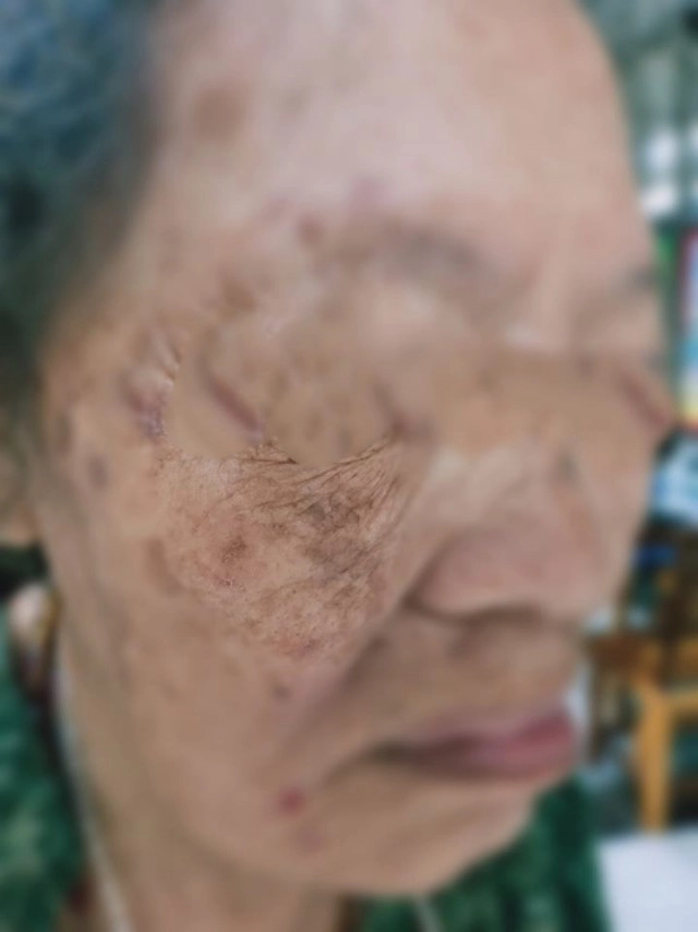 เพจดังเผย อย่าเพิ่งแตกตื่น ปมลูกเอางาดำให้อาม่ากิน!