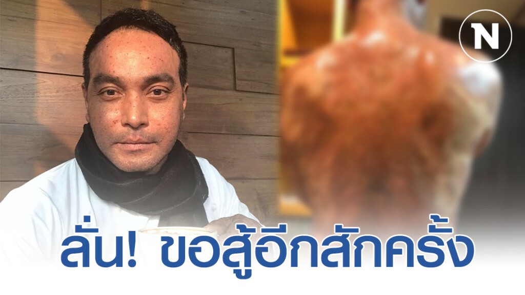 สุดน่าสงสาร! "วินัย" โพสต์ เจ็บนะ เเต่อดทน ขอลองสู้อีกสักครั้ง