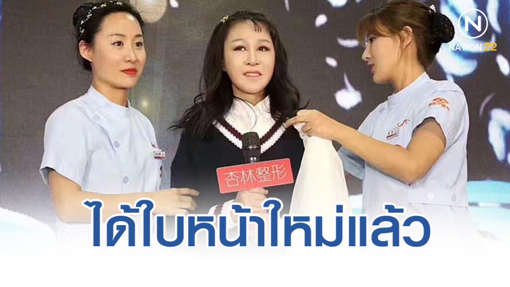 เด็กหญิงจีนหน้าแก่ ได้ใบหน้าใหม่แล้ว เด็กหญิงจีนหน้าแก่ ได้ใบหน้าใหม่แล้ว