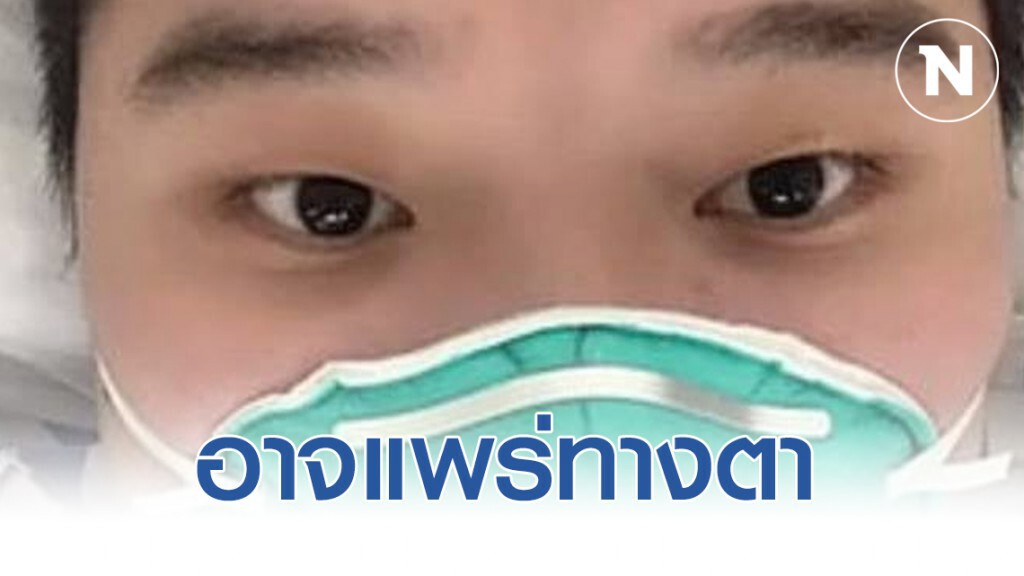 ไวรัสโคโรน่าตัวใหม่ อาจแพร่ทางตา