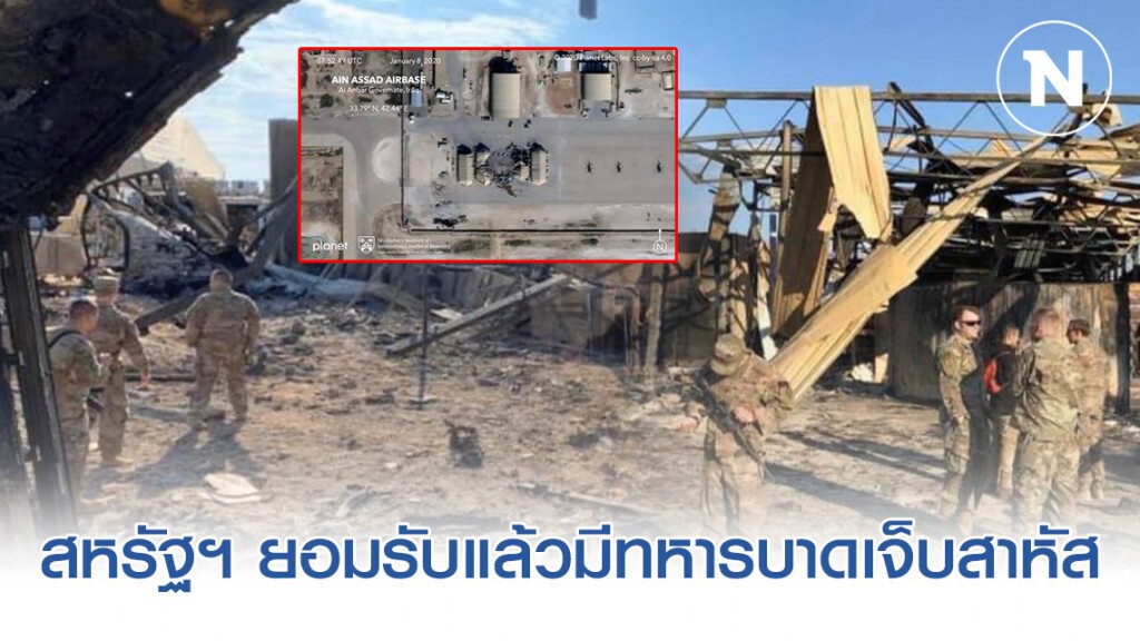 สหรัฐฯ ยอมรับแล้วมีทหารบาดเจ็บสาหัส จากถูกอิหร่านถล่ม