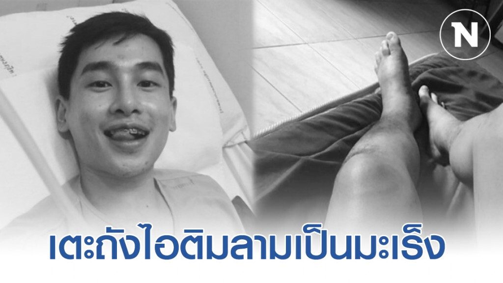 พ่อล้มทั้งยืน! เเพทย์เผย ดาราหนุ่มเสียชีวิต เพราะเดินเตะถังไอติมลามเป็น มะเร็งระยะสุดท้าย