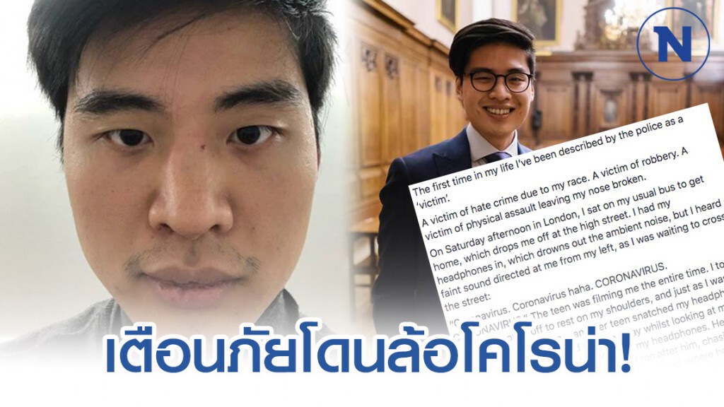 หนุ่มไทยเตือนภัย เป็นเหยื่อโจ๋ชาวอังกฤษ โดนล้อไวรัสโคโรน่า หนุ่มไทยเตือนภัย เป็นเหยื่อโจ๋ชาวอังกฤษ โดนล้อไวรัสโคโรน่า