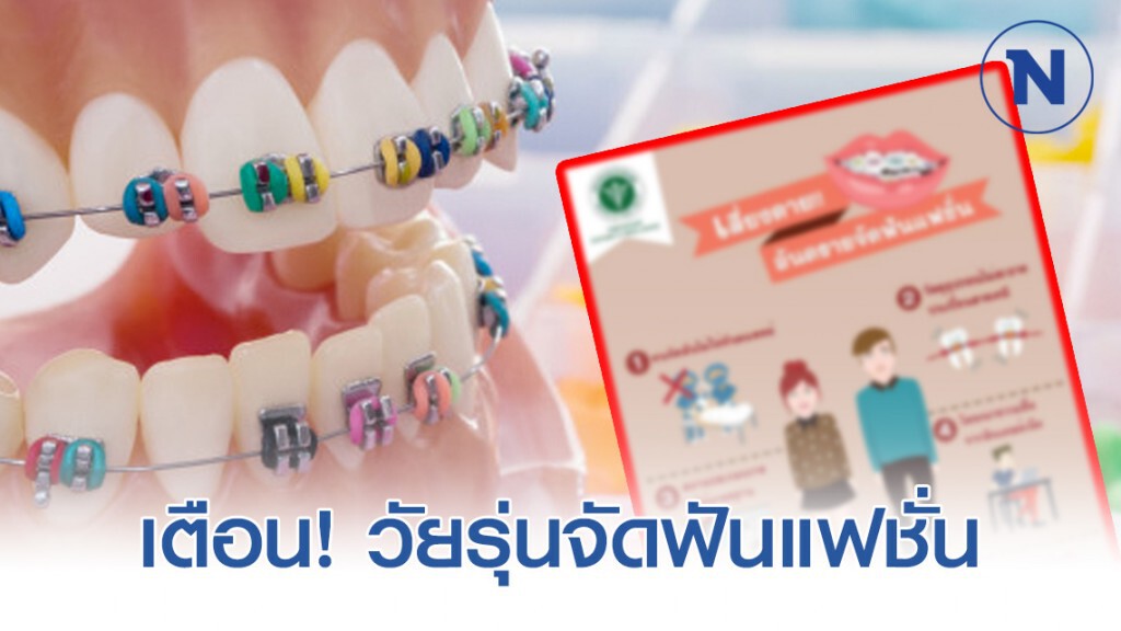 "กรมการแพทย์" เตือน! วัยรุ่นจัดฟันแฟชั่น เป็นวิธีที่ไม่ถูกต้อง อันตรายถึงชีวิต