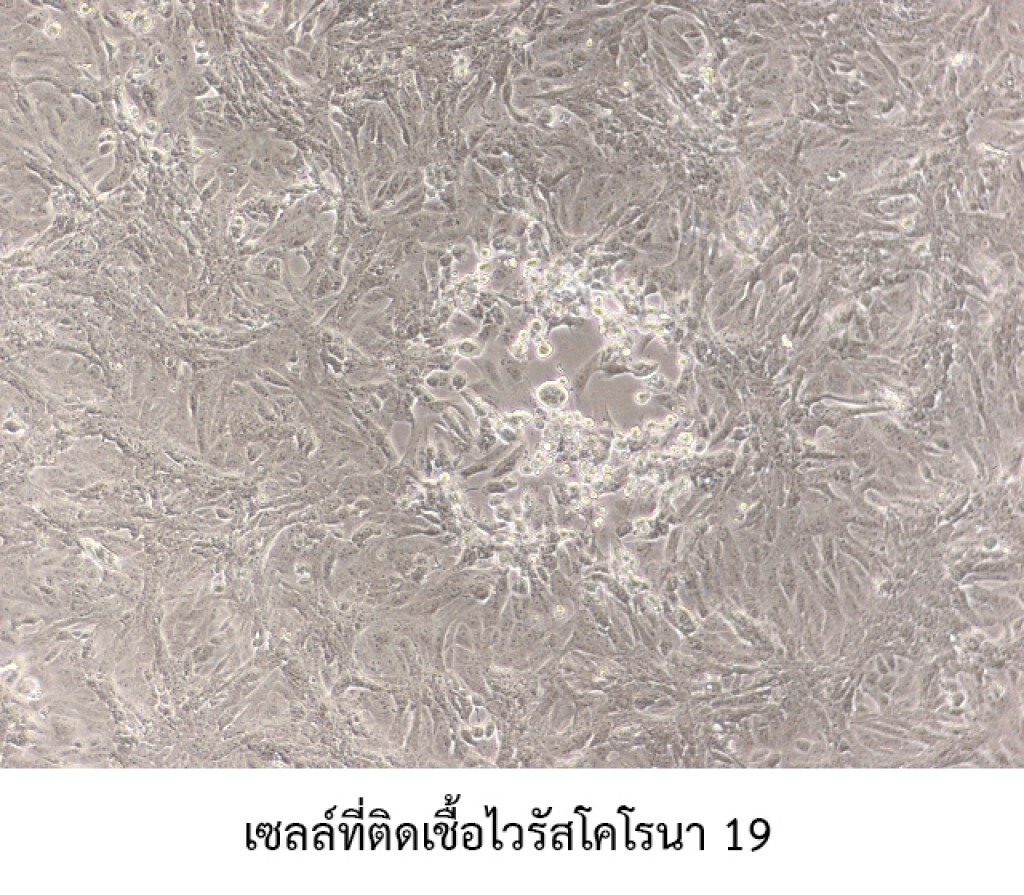 หมอไทยไม่รอ! เร่งพัฒนา "วัคซีน" ป้องกันไวรัส COVID-19