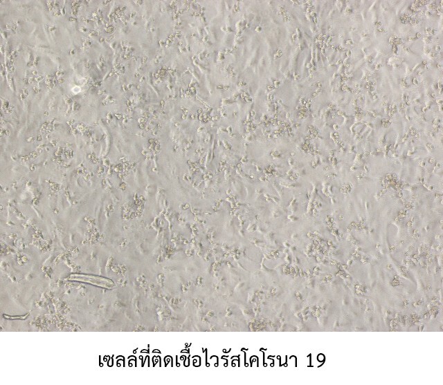 หมอไทยไม่รอ! เร่งพัฒนา "วัคซีน" ป้องกันไวรัส COVID-19