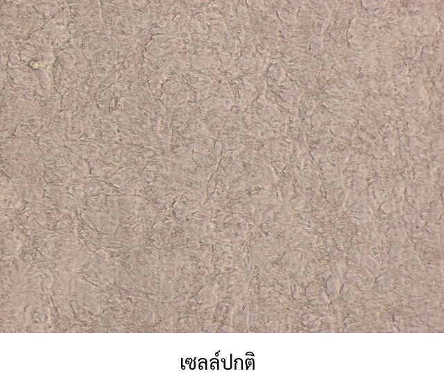 หมอไทยไม่รอ! เร่งพัฒนา "วัคซีน" ป้องกันไวรัส COVID-19