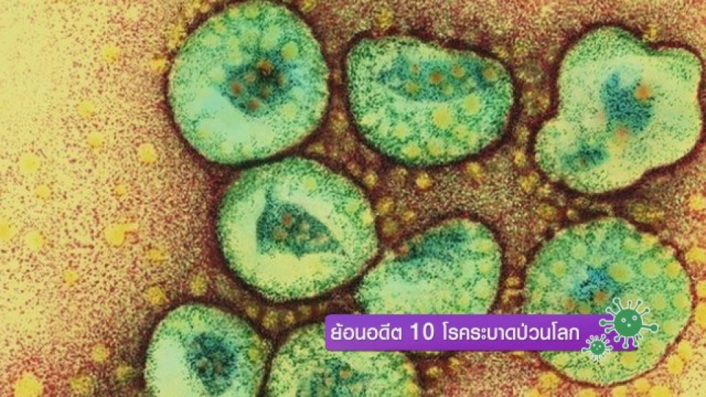 ย้อนอดีต 10 โรคระบาดป่วนโลก ย้อนอดีต 10 โรคระบาดป่วนโลก
