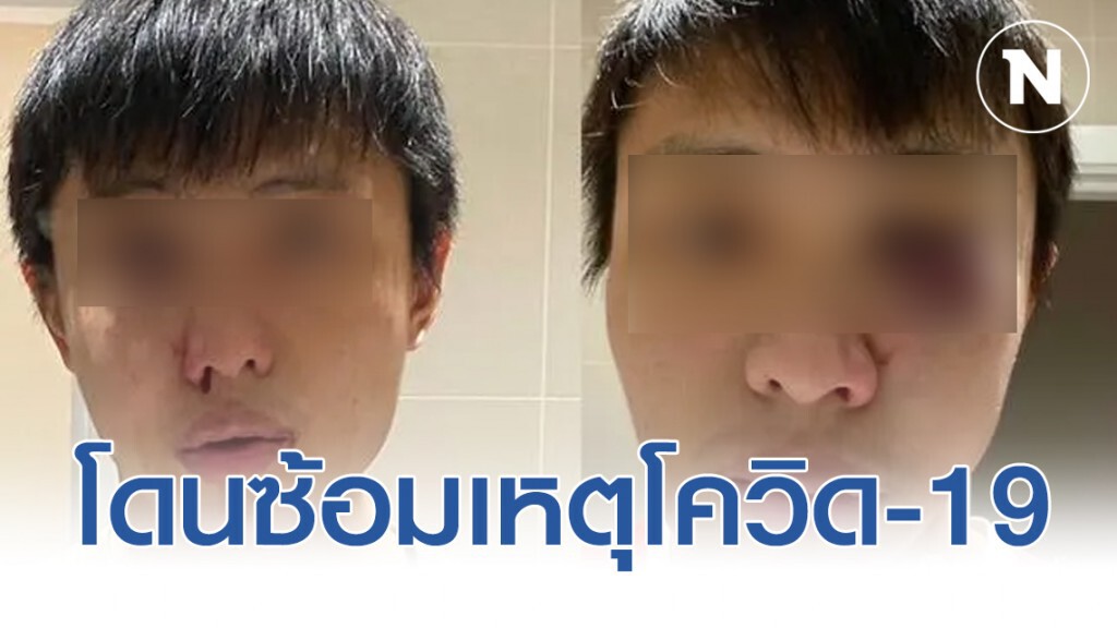 นศ.สิงคโปร์ ถูกวัยรุ่นอังกฤษเหยียดจากโควิด-19 ก่อนถูกซ้อม