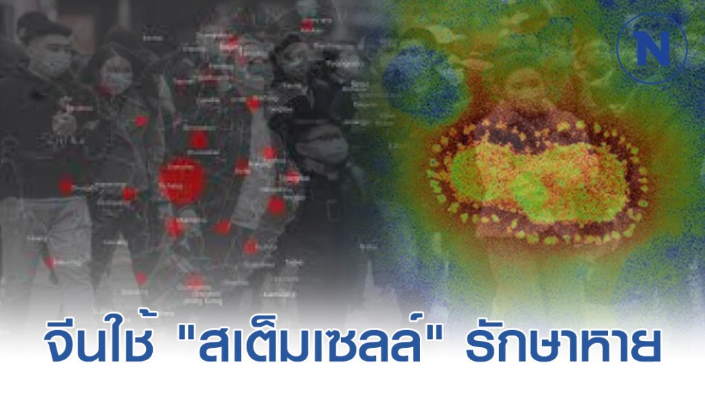 จีน เผยผลทดลองใช้ "สเต็มเซลล์" รักษาผู้ป่วยวิกฤต โควิด-19 หาย