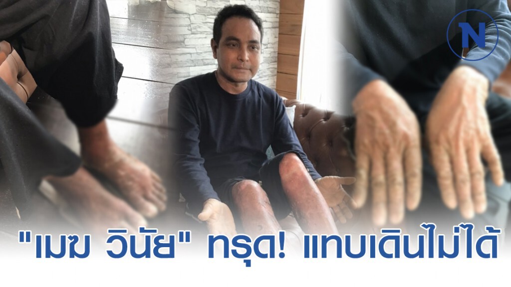 "เมฆ วินัย" ทรุดหนักอีก! แทบเดินไม่ได้ ใจสู้เริ่มธุรกิจใหม่