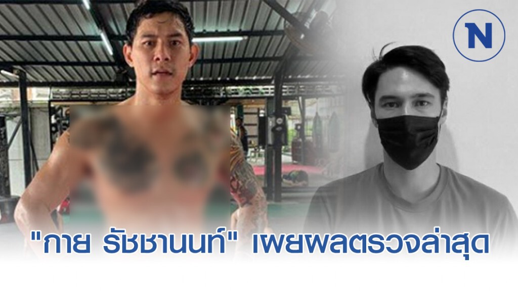 "กาย รัชชานนท์" เผยผลตรวจหลังถ่ายละครร่วม "แมทธิว ดีน" "กาย รัชชานนท์" เผยผลตรวจหลังถ่ายละครร่วม "แมทธิว ดีน"