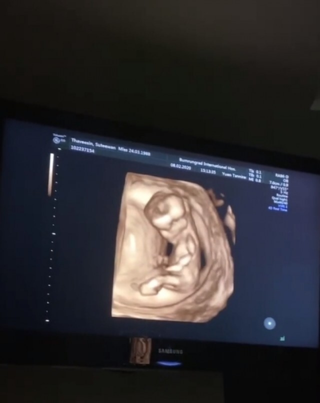 "ดีเจแมน ใบเตย" เผยเพศลูกคนแรก พร้อมกับตั้งชื่อไว้แล้ว!