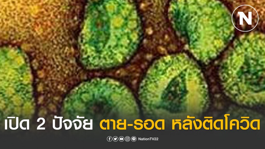 เปิด 2 ปัจจัย ตาย-รอด หลังติดโควิด