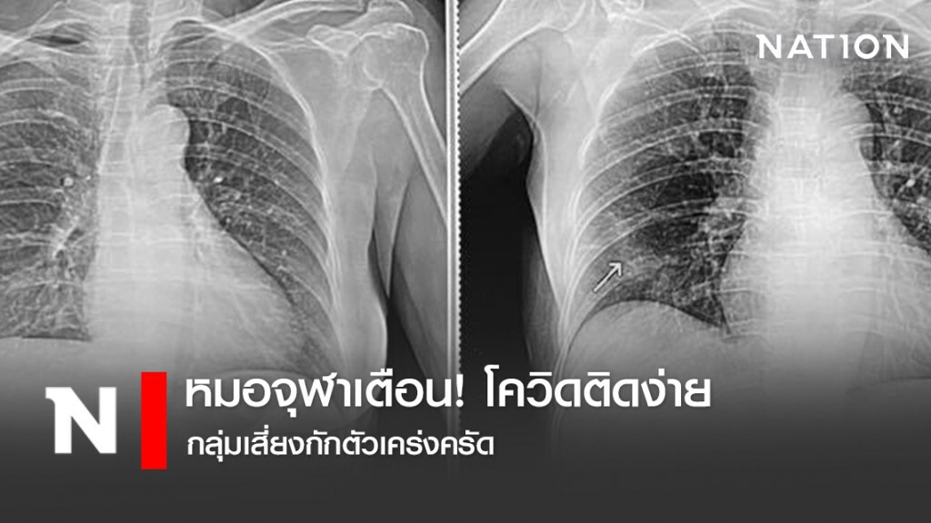 หมอจุฬาเตือน! โควิดติดง่าย กลุ่มเสี่ยงกักตัวเคร่งครัด