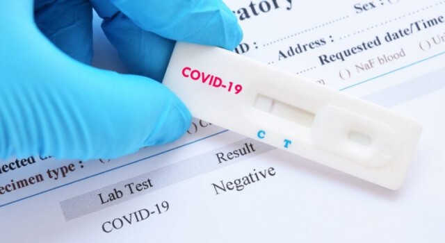 กรมวิทย์ฯ ตอบข้อสงสัย Rapid Test (แลบบิทเทส)