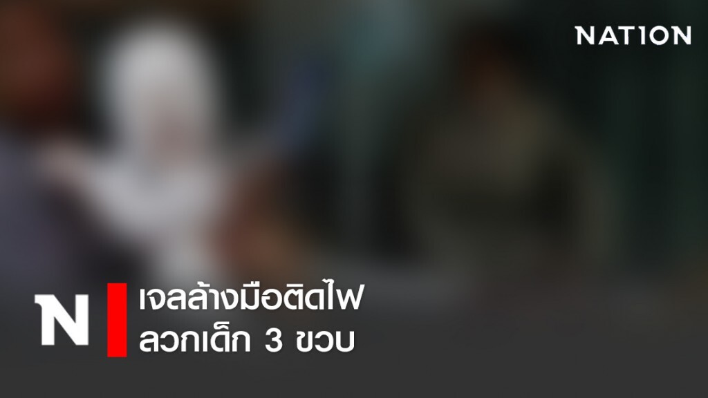 อุทาหรณ์! เจลล้างมือติดไฟลวกเด็ก 3 ขวบ
