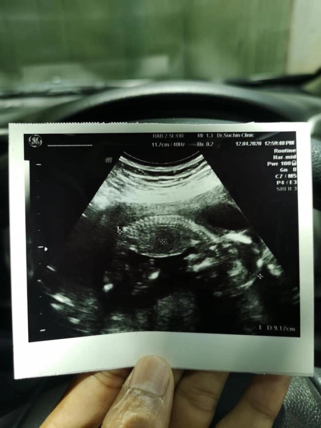 "เสกสรร" ได้ลูกคนที่ 2 เป็นผู้ชาย