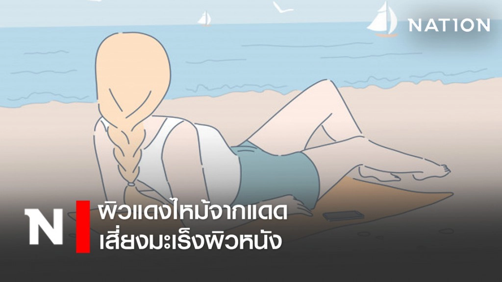ผิวแดงไหม้จากแดดเสี่ยงมะเร็งผิวหนัง